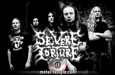 Severe Torture interview